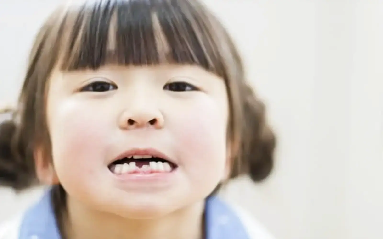 歯のエナメル質が薄い